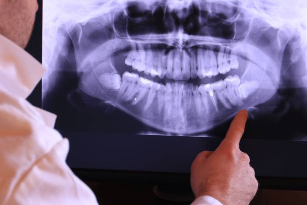 Best 24-Hour Emergency Dental Care in Lake Kerr, FL
