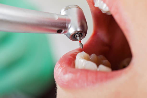 Best Emergency Orthodontic Repairs in Lake Kerr, FL